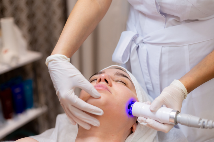 Laser Pigmentation Treatment
